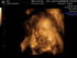 Baby062011
