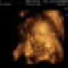 Baby062011